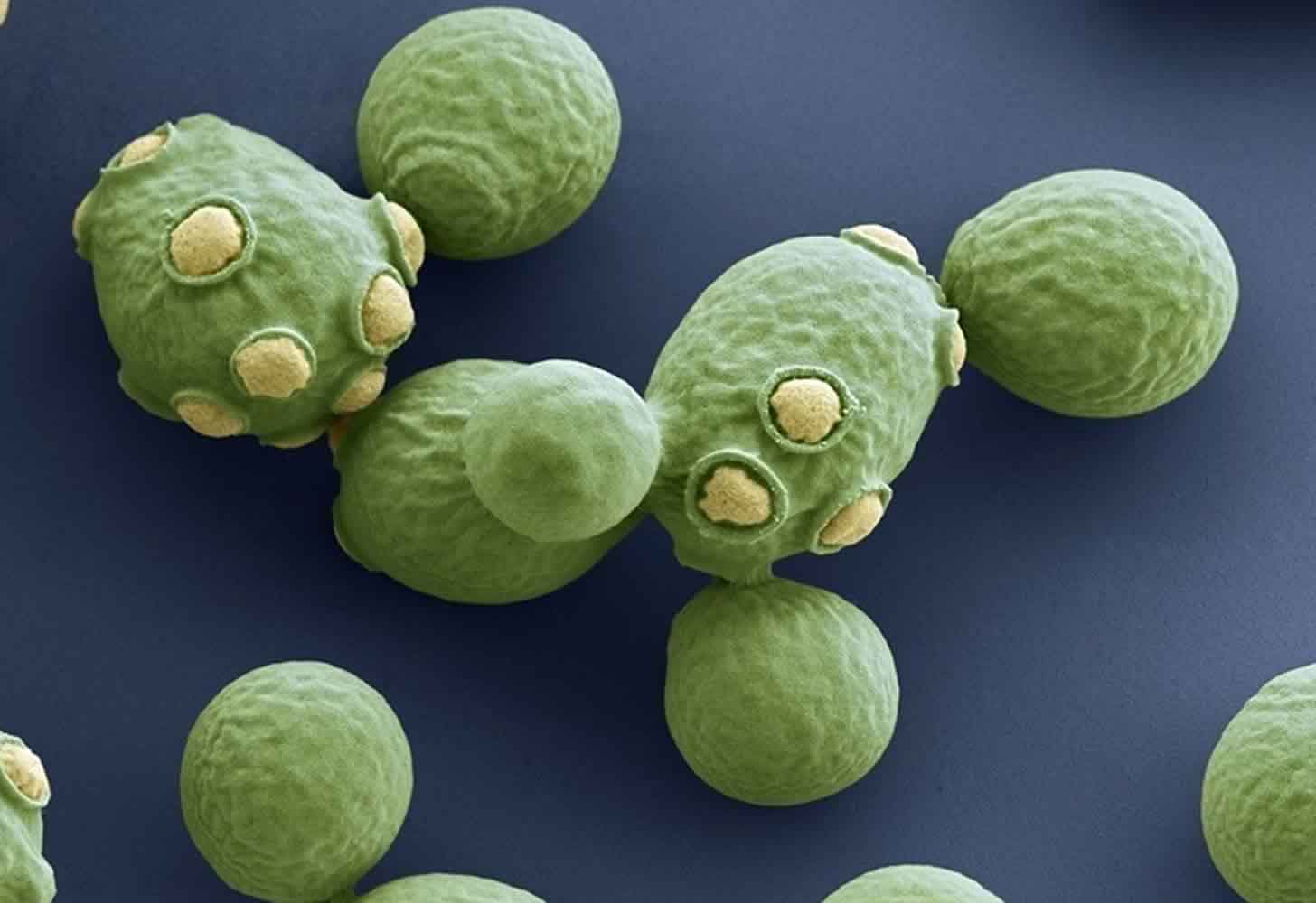 Vin: Hvad er gæring, og hvorfor sker det?